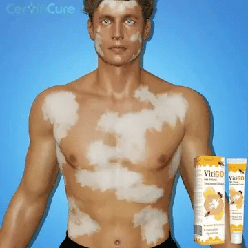 BienenKlar™ | Stellen Sie Hautverfärbungen in nur 7 Tagen wieder her!