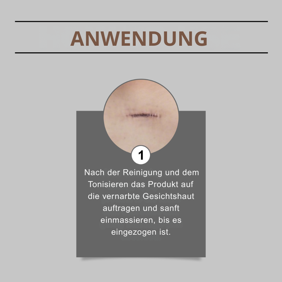 ScarEase™ | Narbenberuhigungsstift