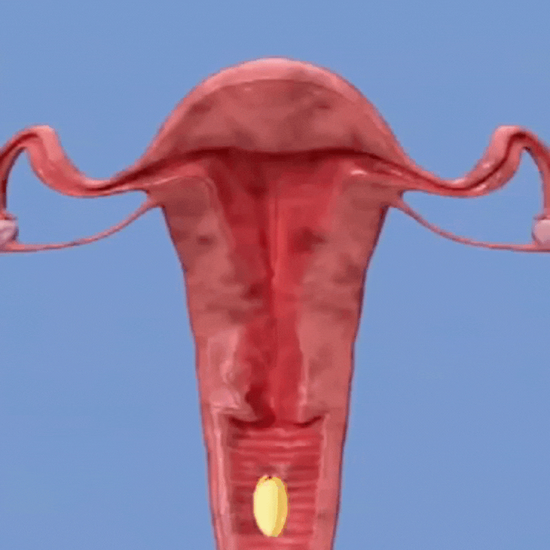 VaginalPflege™ | Beseitigen Vaginale Beschwerden In Nur Wenigen Minuten!