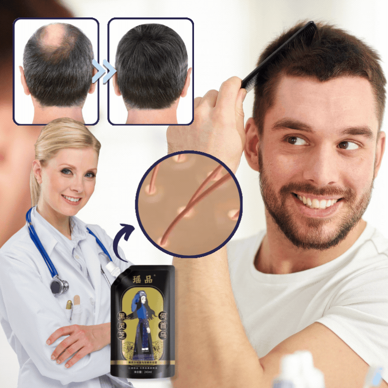 WachsenMax™ | Haarwachstumsserum