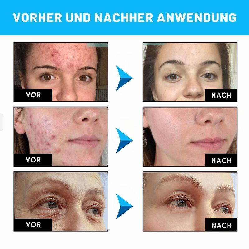RadiantHaut™ | Hautglättendes Serum