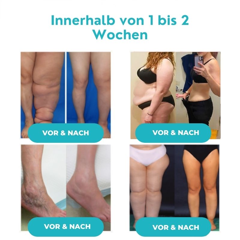 CelluKlar™ | Ultraschall-Bänder zur Cellulite-Entfernung und Entgiftung