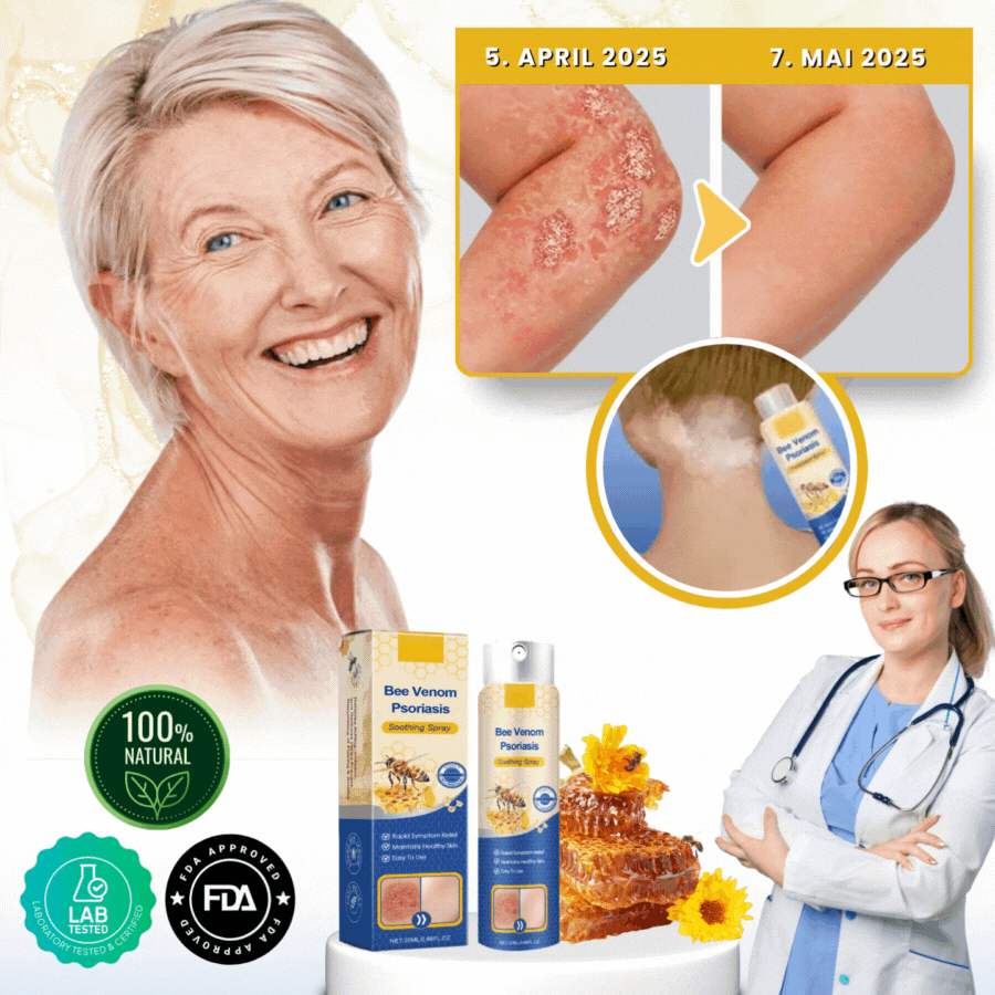 PsoriaFix™ | Bienenvenom Psoriasis Beruhigungsspray