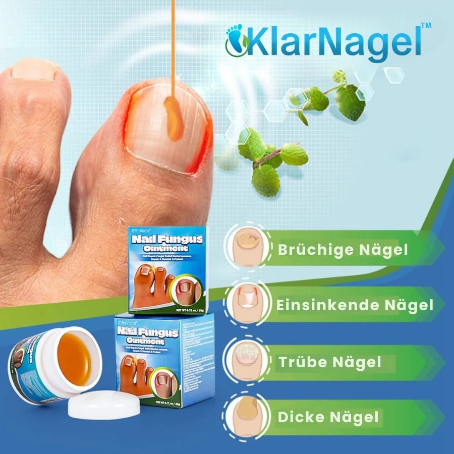 KlarNagel™  | Schnelle Antipilz-Salbe