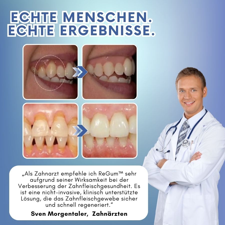 ReGum™ | Zahnfleisch Sofort-Beruhigungs-Gel