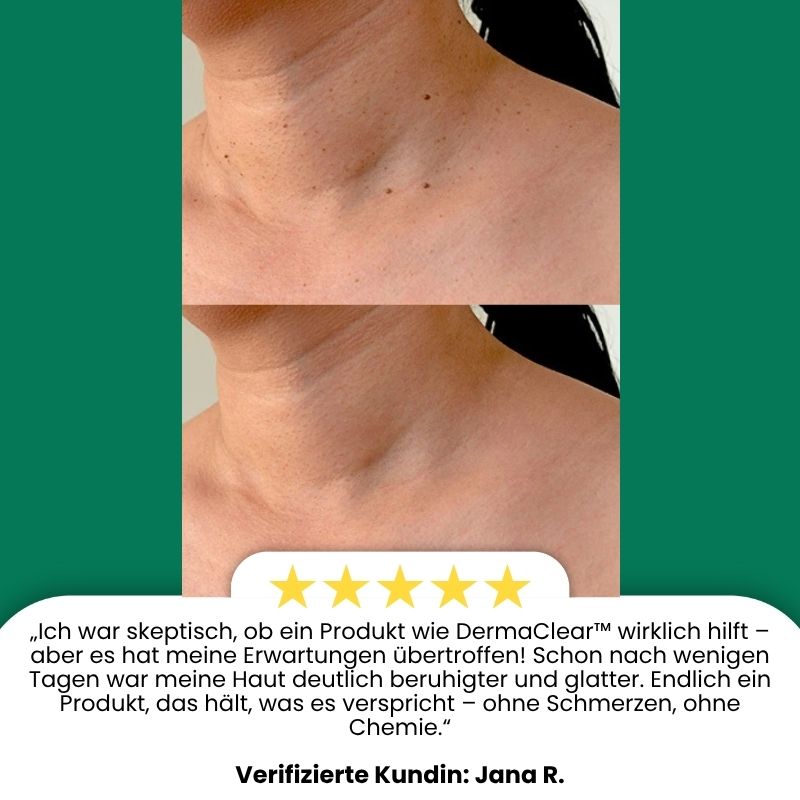DermaClear™ | Botanische Mikronadel-Creme zur gezielten Hautbildkorrektur