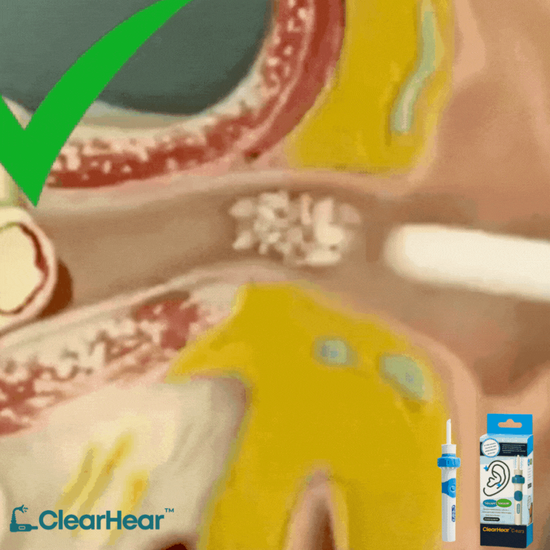 ClearHear™ | Sanftes Ohrreinigungsgerät ohne Chemie