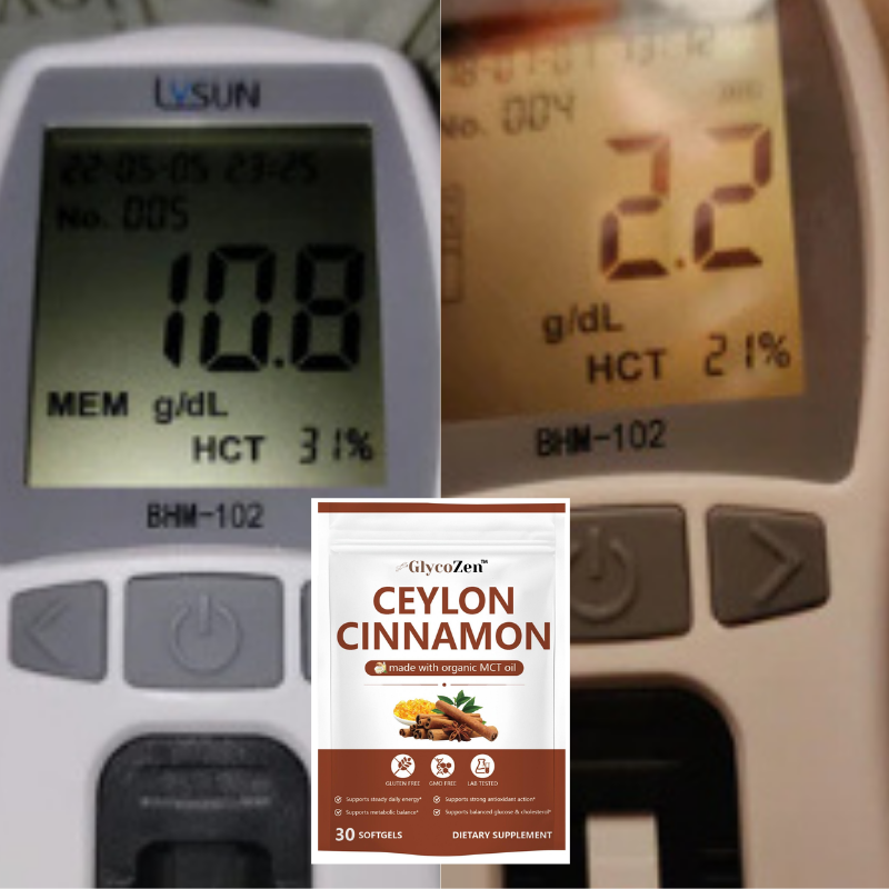 GlycoZen™Weichkapseln