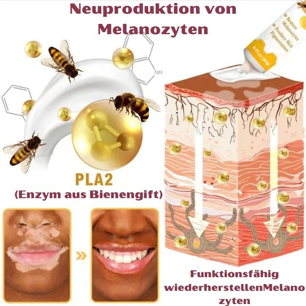 BienenKlar™ | Stellen Sie Hautverfärbungen in nur 7 Tagen wieder her!