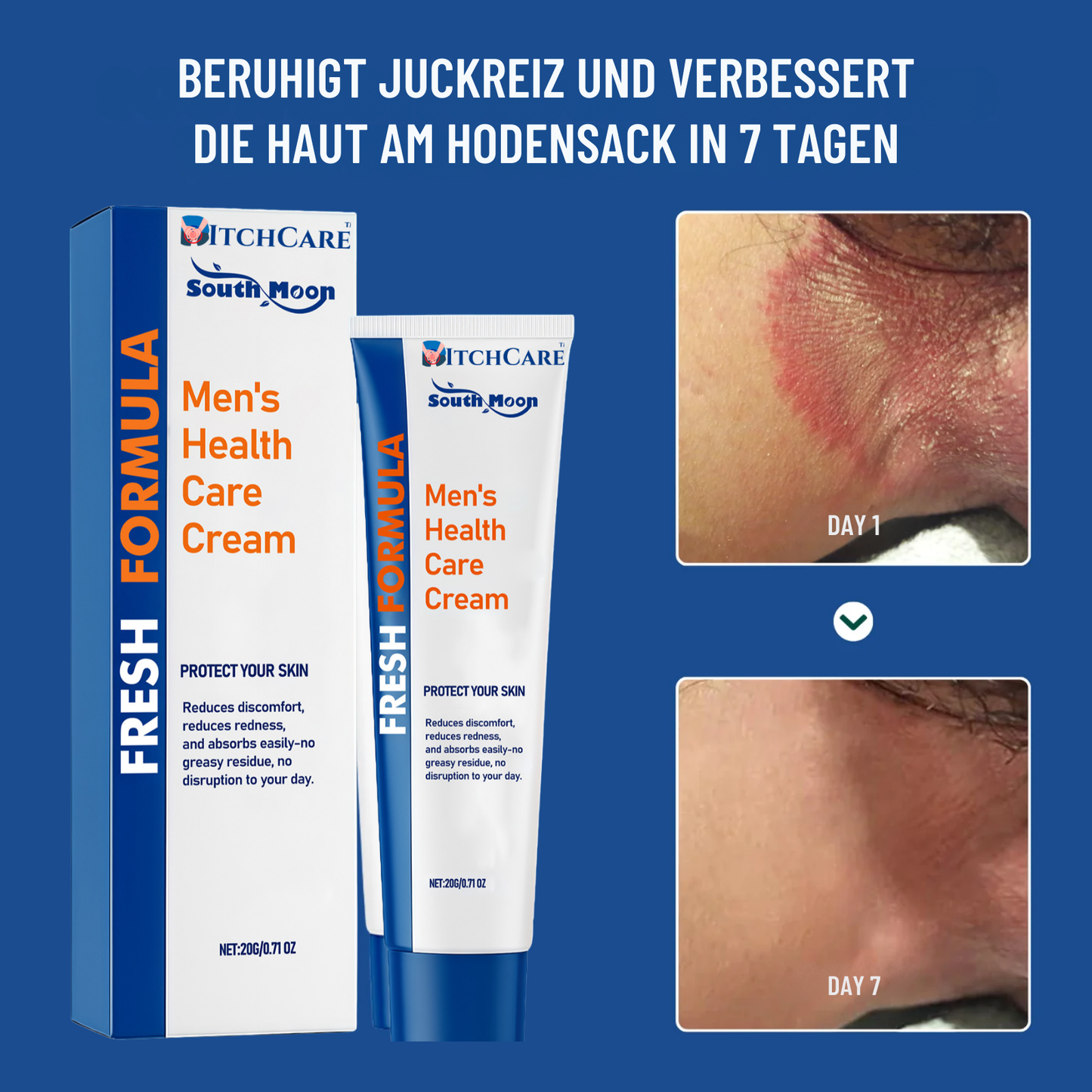 ItchCare™ | 95 % Sofortige Linderung!