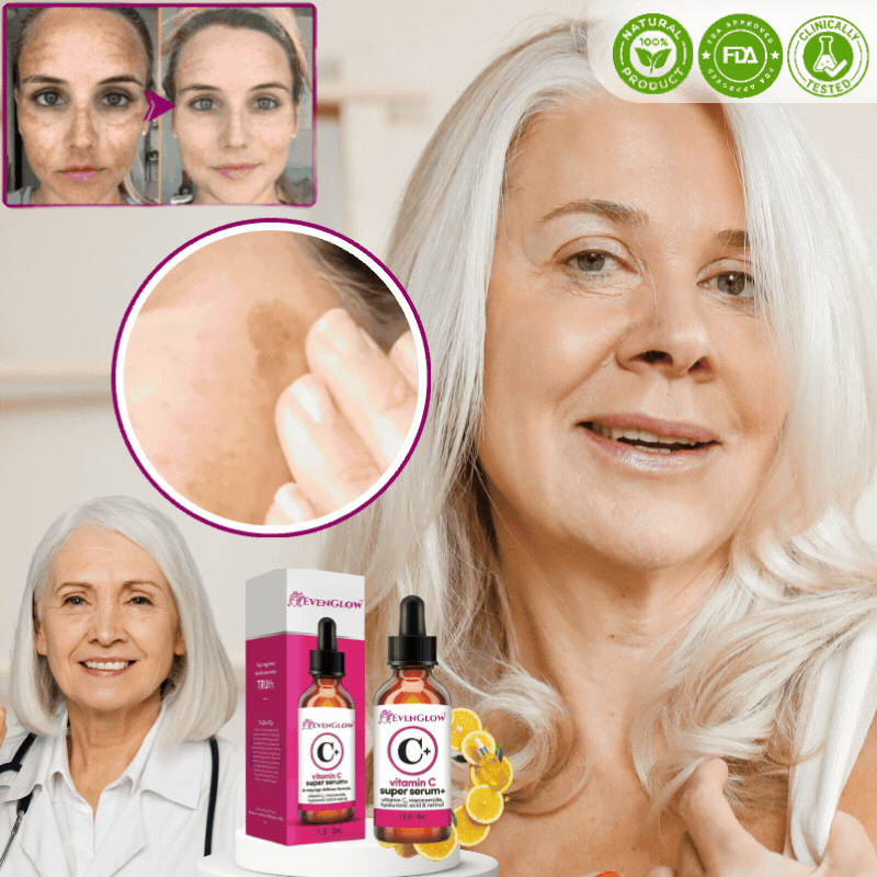 EvenGlow™ Serum | Bleicht 92 % der dunklen Flecken!