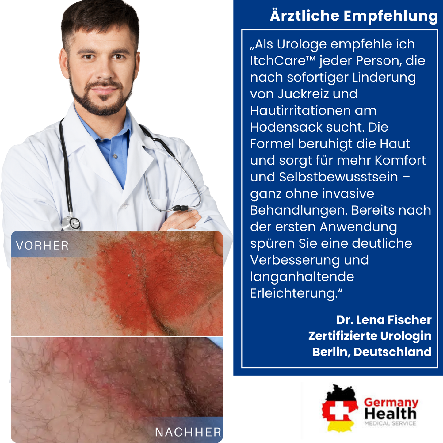 ItchCare™ | 95 % Sofortige Linderung!