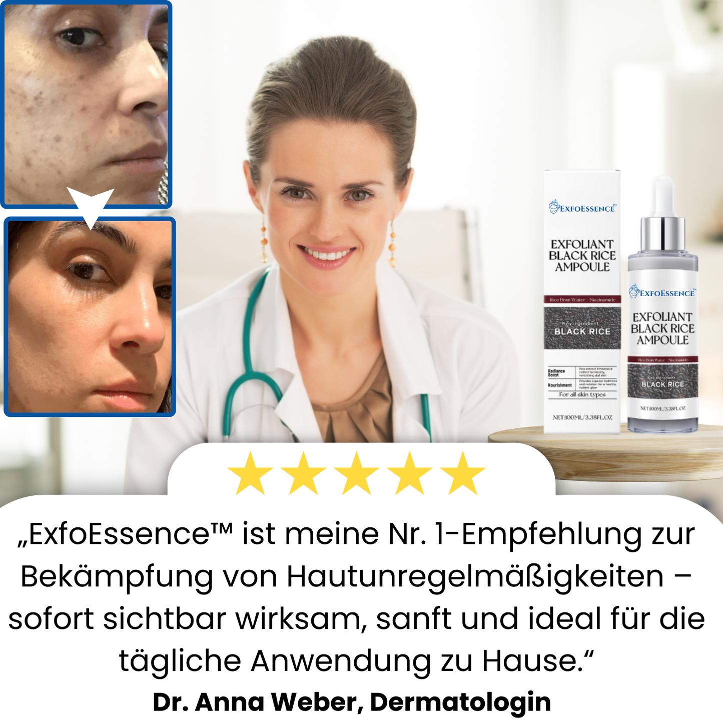 ExfoEssence™ | Erlebe frische, 95% glatte Haut sofort!