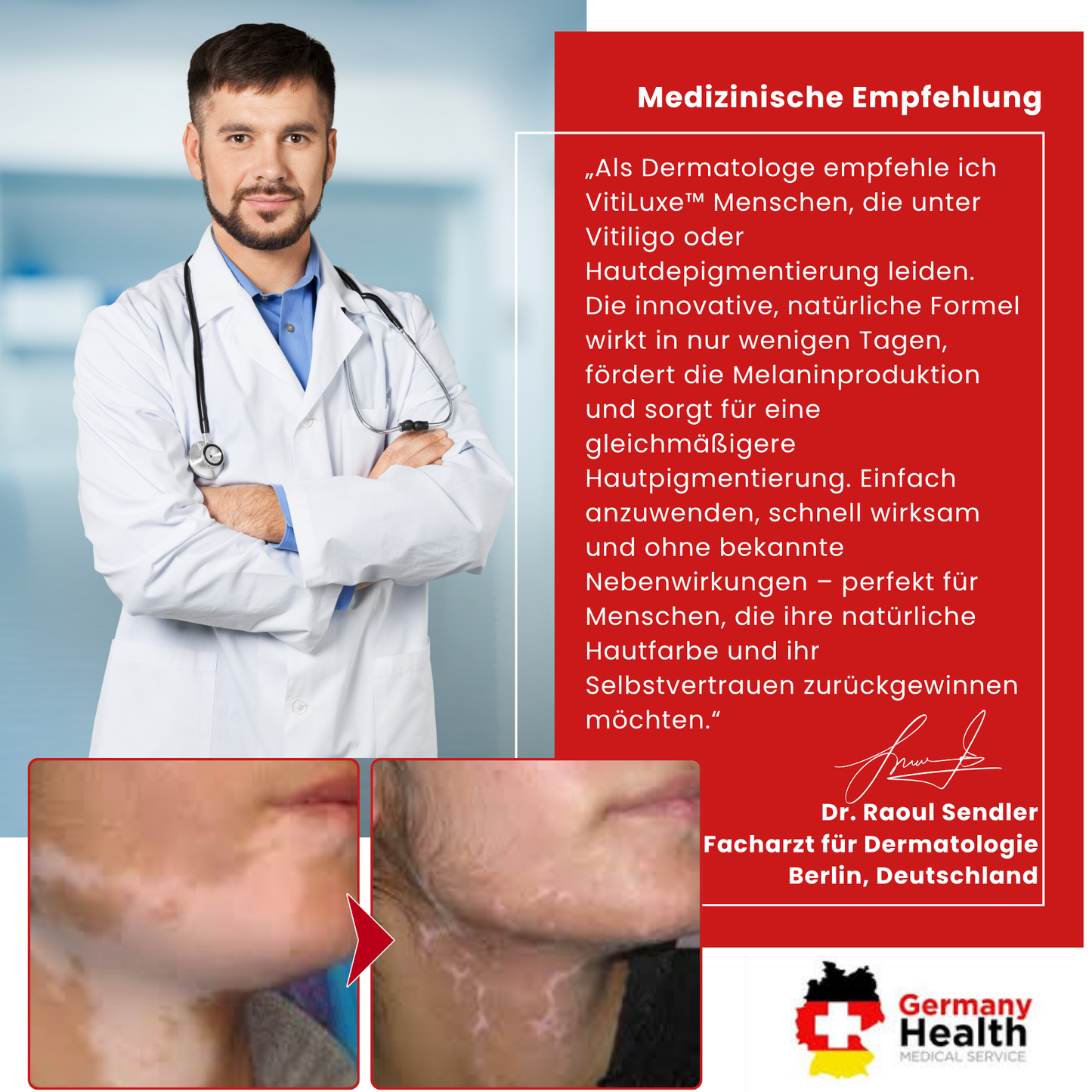 VitiLuxe™ | Stellen Sie Ihre Haut in 7 Tagen!