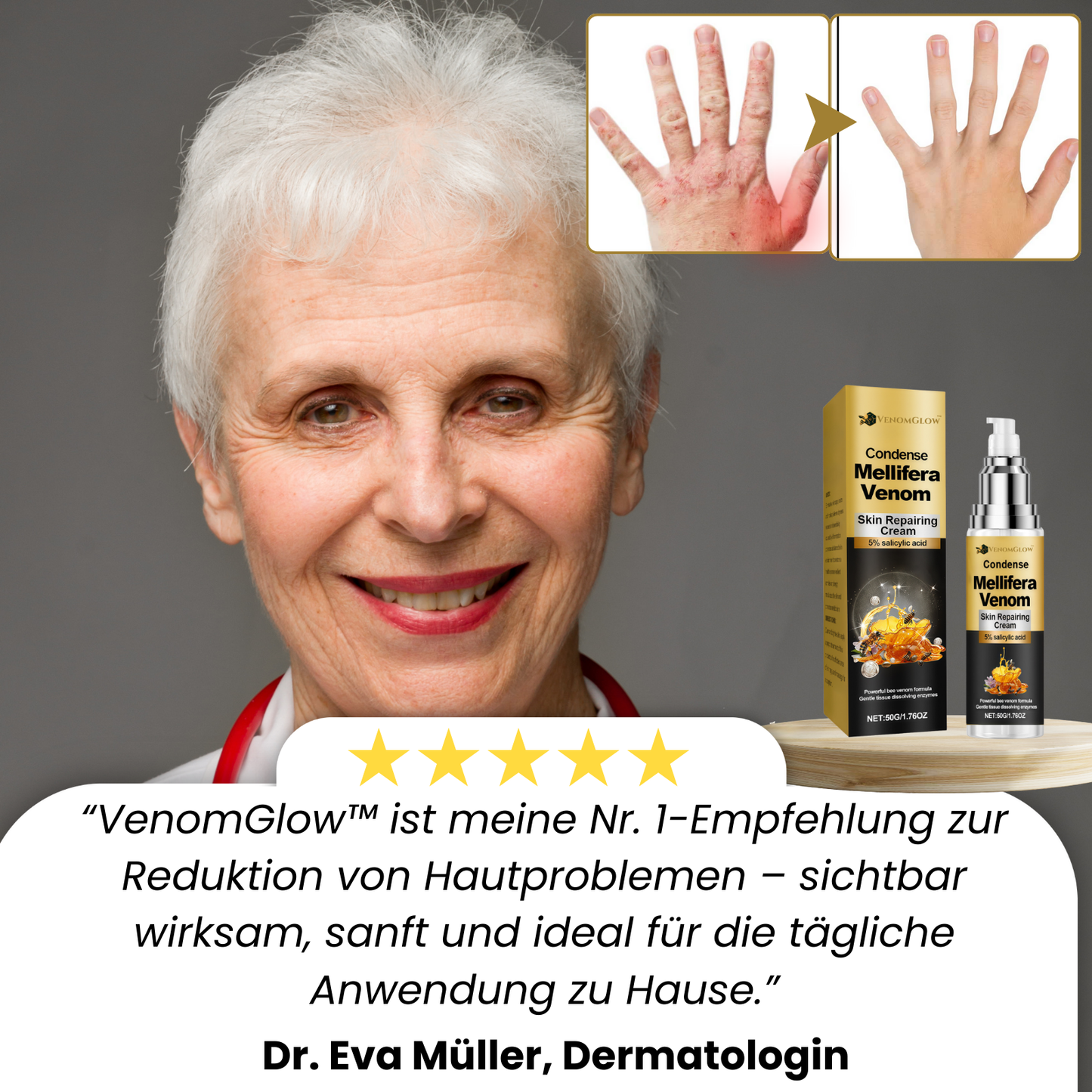 VenomGlow™ | Weg mit Muttermalen, Warzen & Ekzemen in 1 Woche!