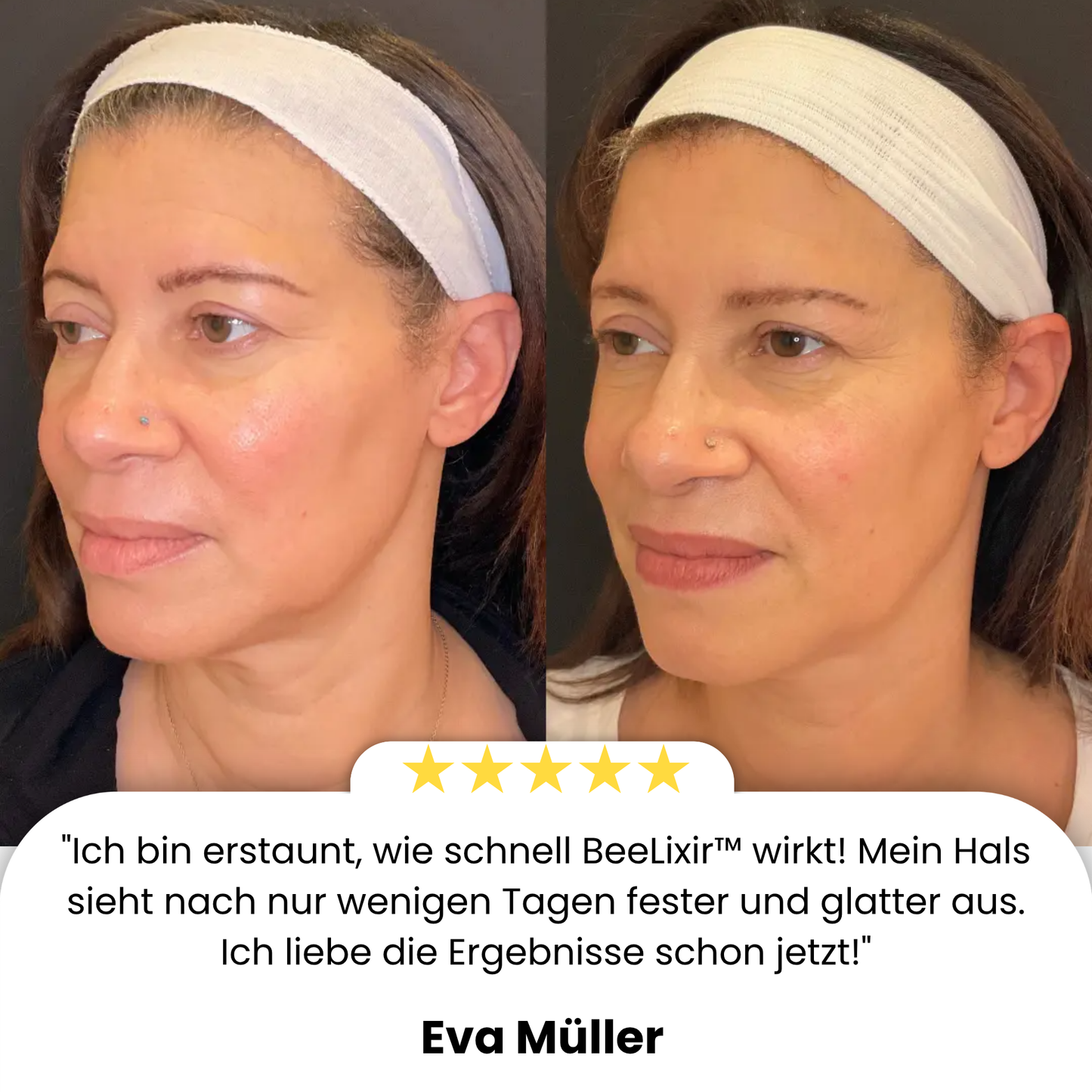 BeeLixir™ | Straffe und hebe deinen Hals in nur 15 Minuten!