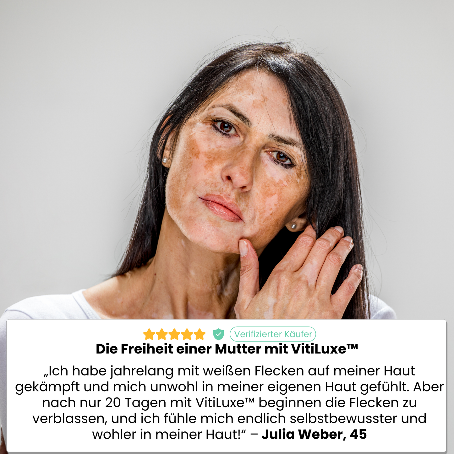 VitiLuxe™ | Stellen Sie Ihre Haut in 7 Tagen!