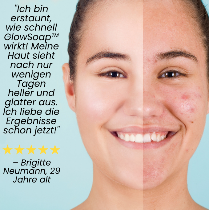 GlowSoap™ | makellose Haut beginnt jetzt – 95% glattere Haut!