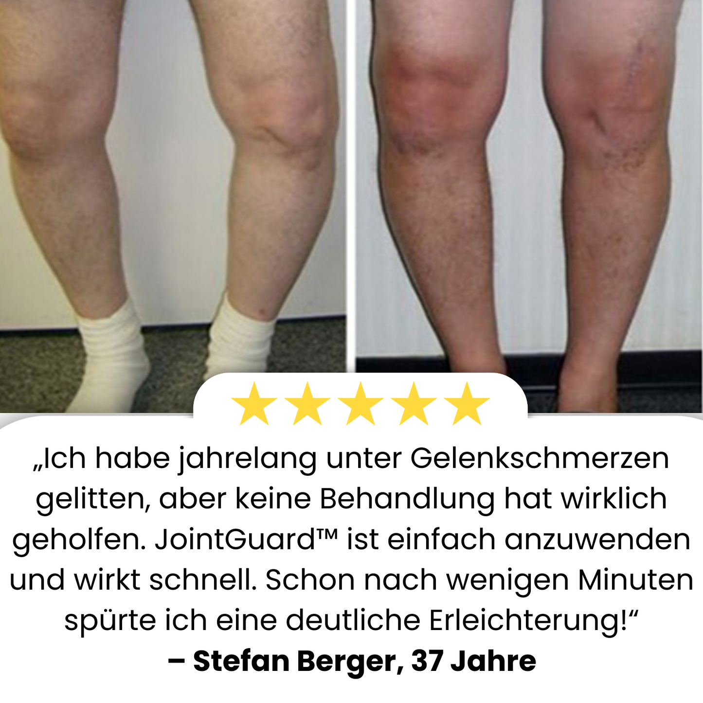 JointGuard™ | Beweglich & Schmerzfrei!
