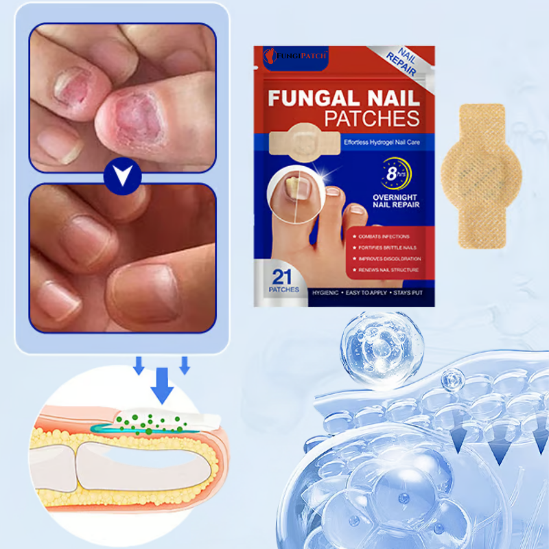 FungiPatch™ | Stellen Sie gesunde Nägel ganz einfach wieder her