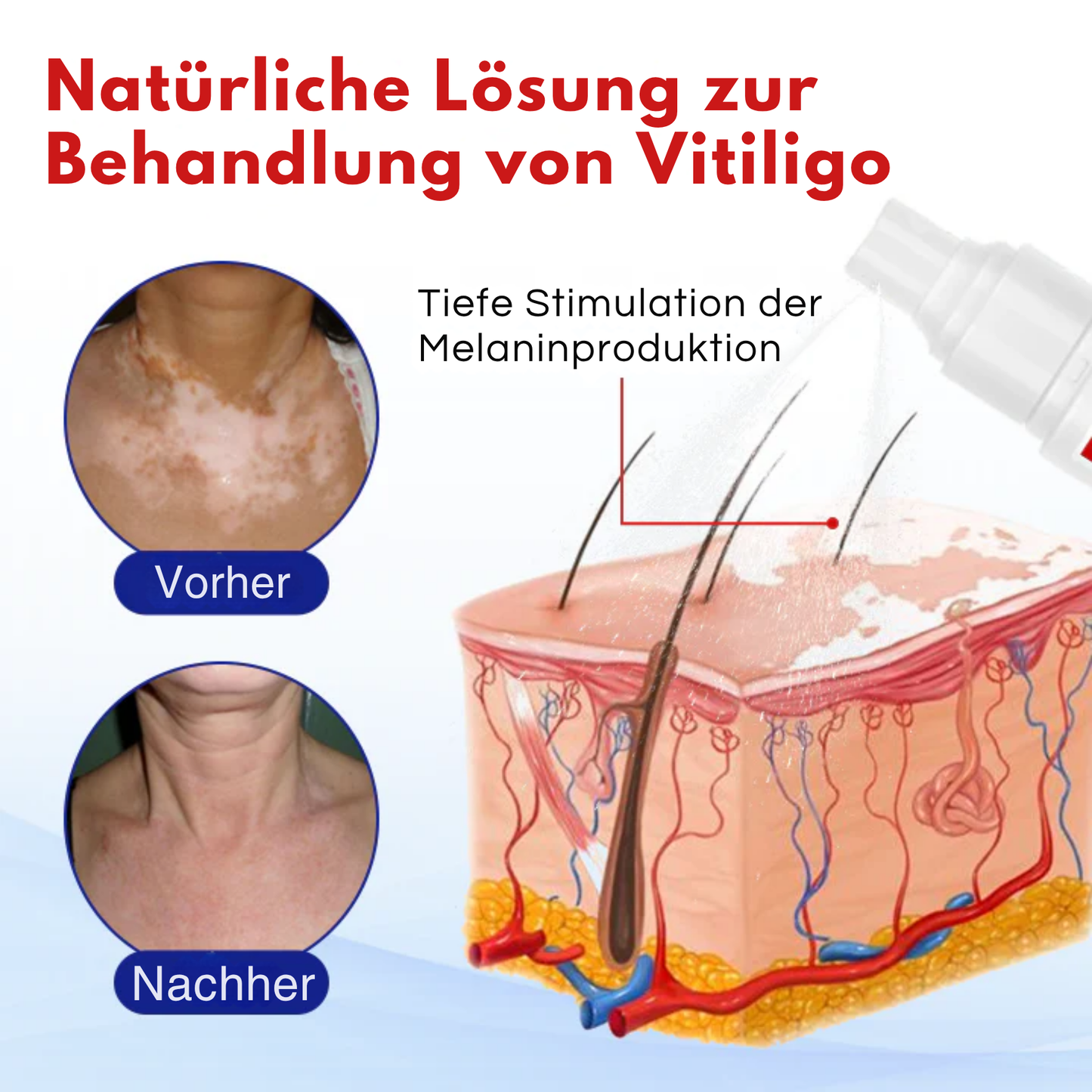 VitiLuxe™ | Stellen Sie Ihre Haut in 7 Tagen!