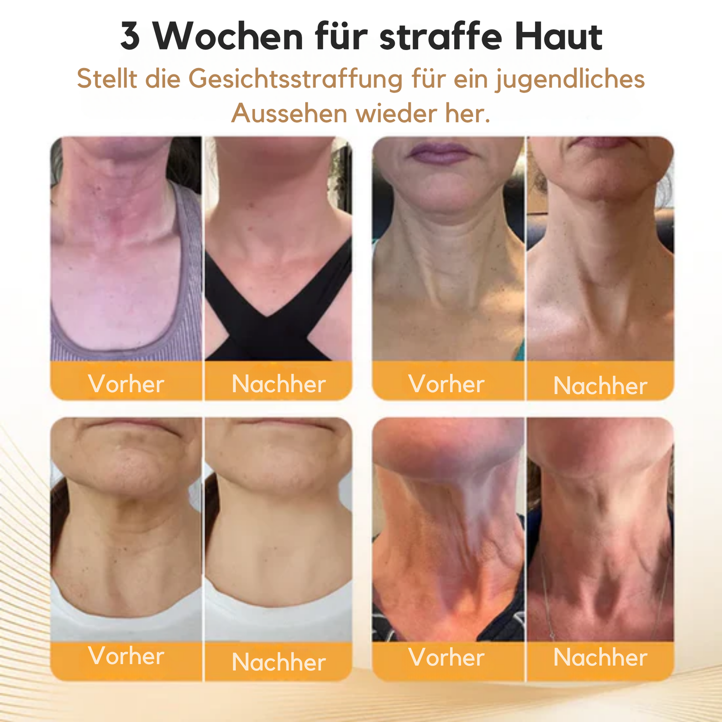BeeLixir™ | Straffe und hebe deinen Hals in nur 15 Minuten!