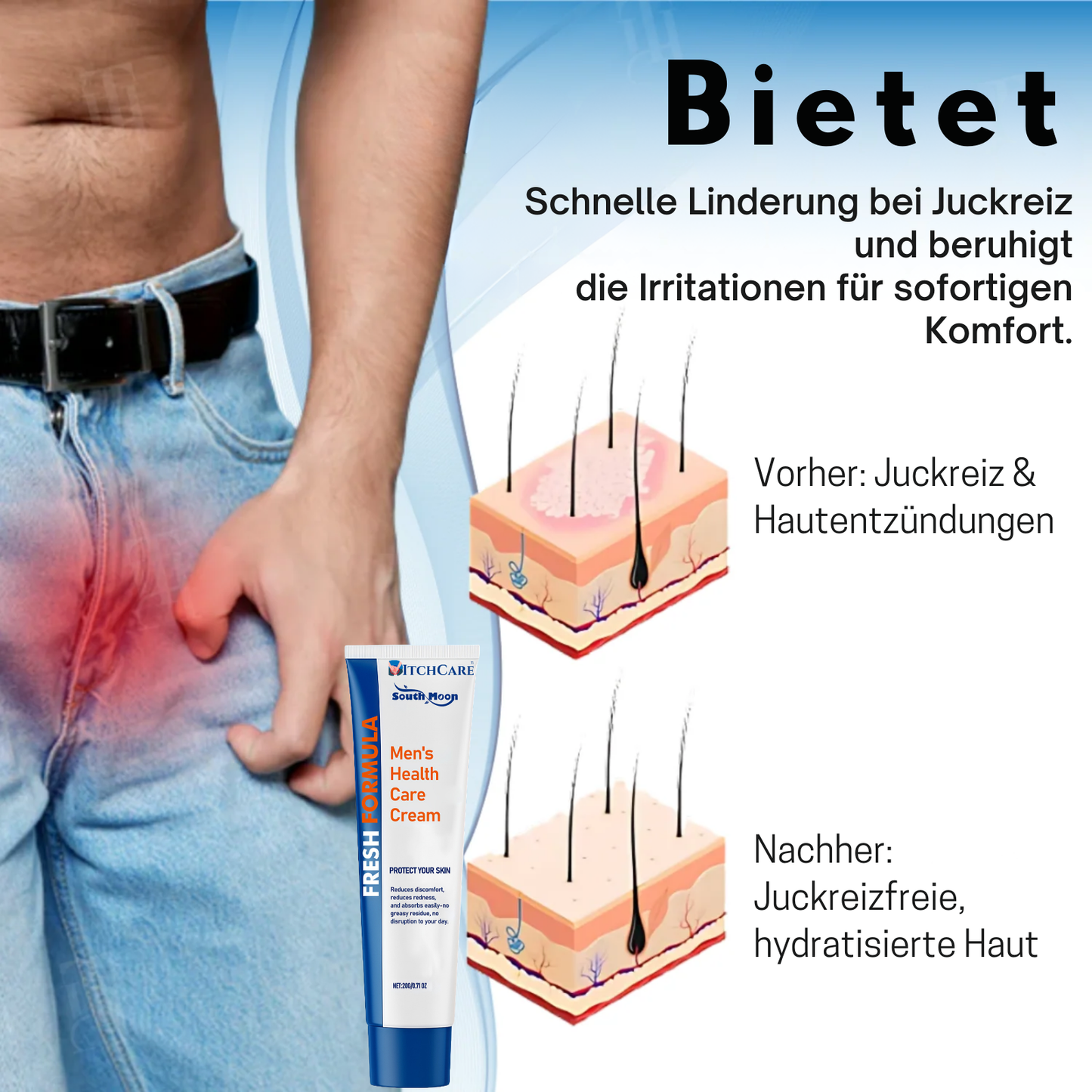ItchCare™ | 95 % Sofortige Linderung!