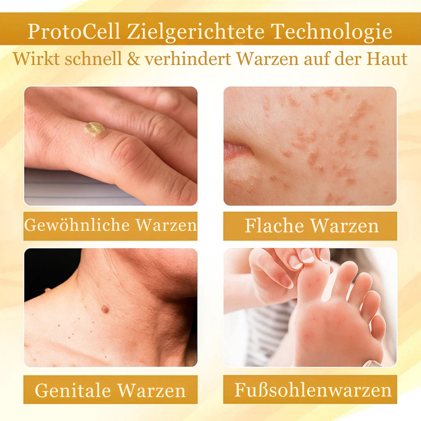 VenomGlow™ | Weg mit Muttermalen, Warzen & Ekzemen in 1 Woche!