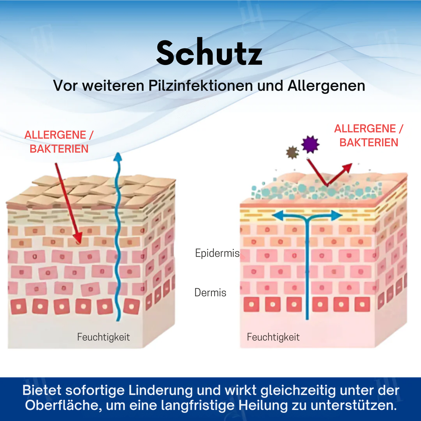 ItchCare™ | 95 % Sofortige Linderung!