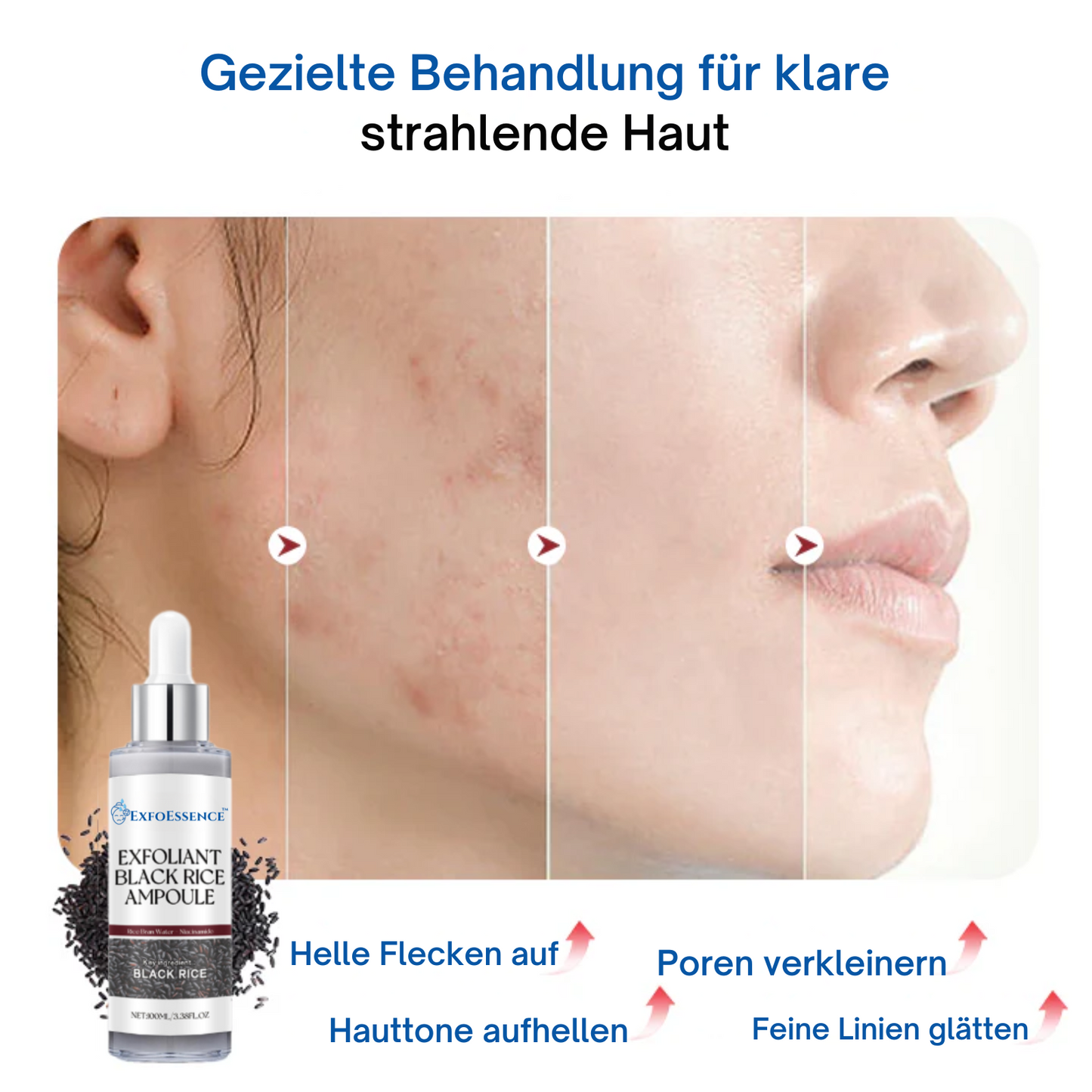 ExfoEssence™ | Erlebe frische, 95% glatte Haut sofort!