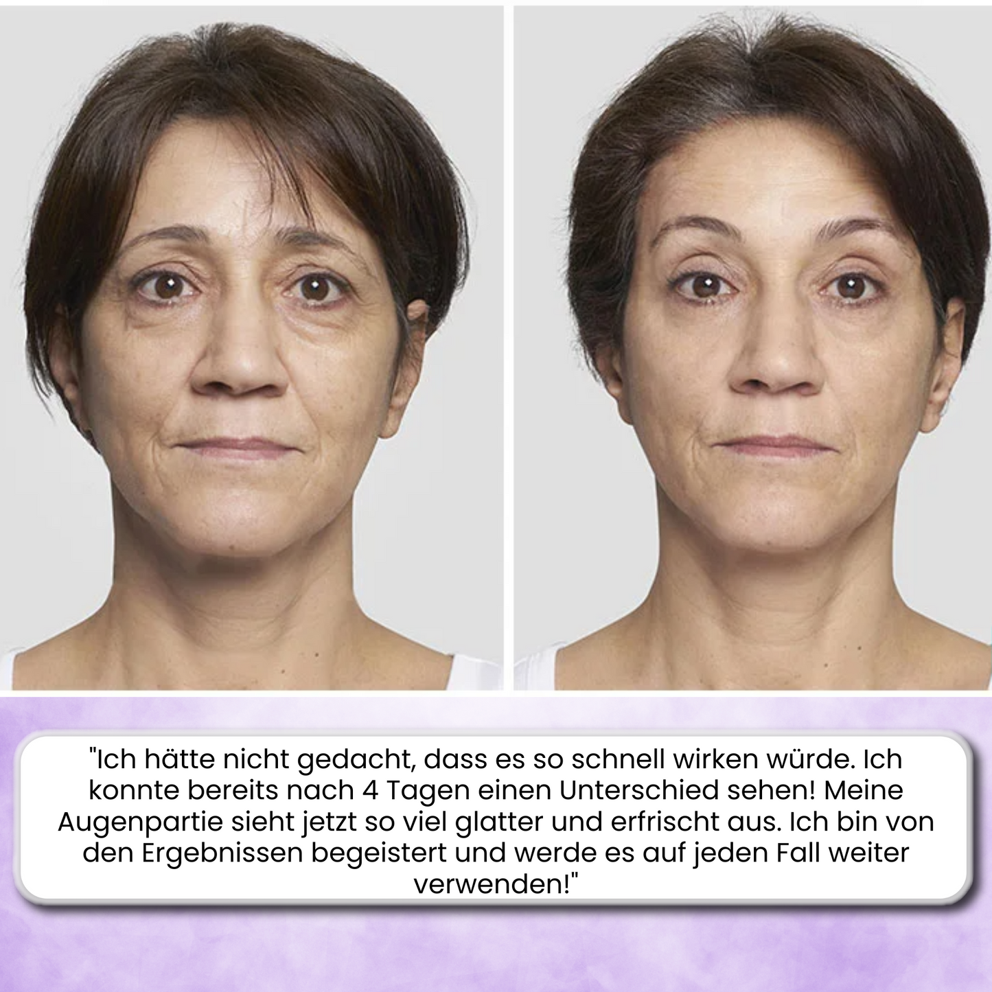 Apilift™ Anti-Aging Augencreme Straffere in 7 Tagen!