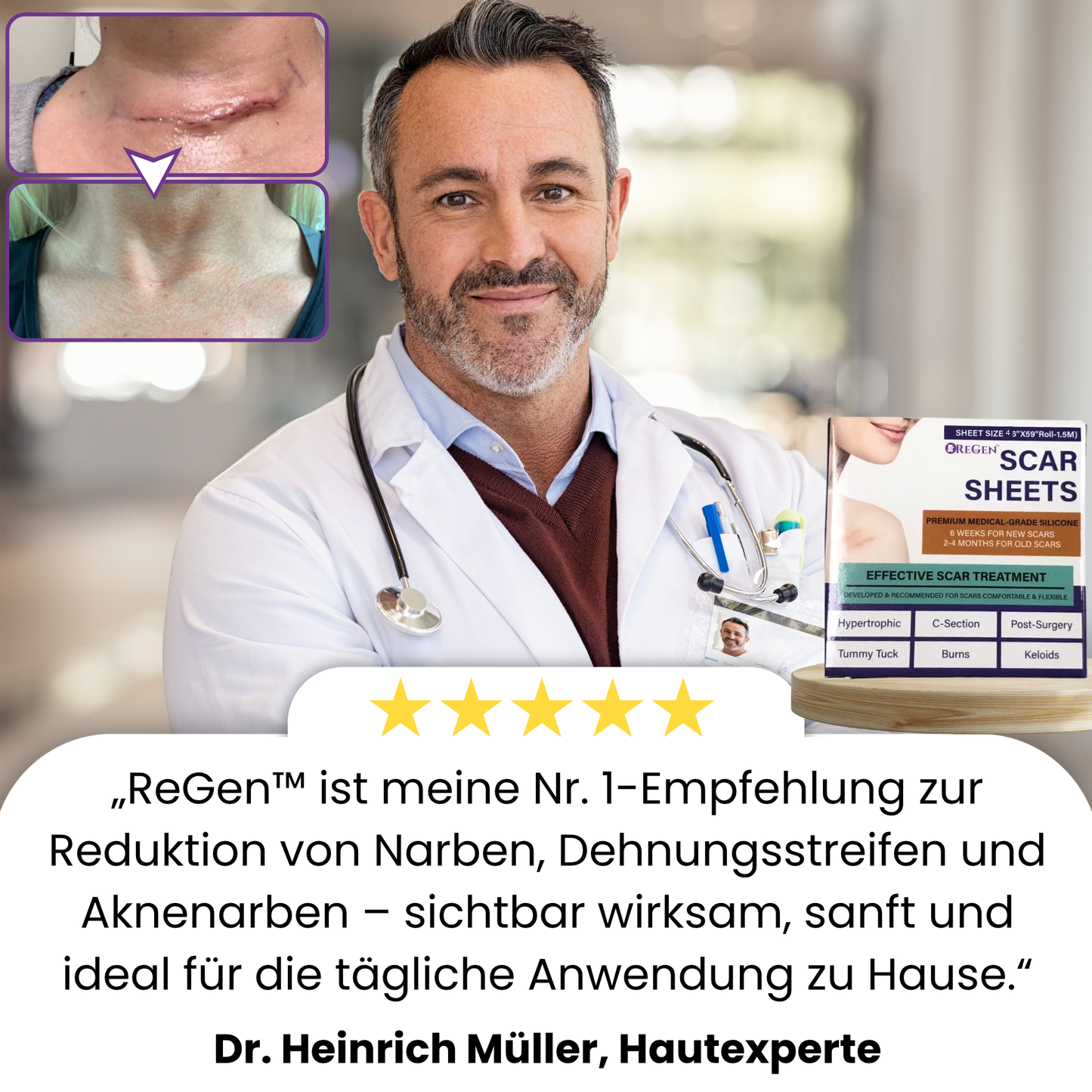 ReGen™ | Zerstöre Hartnäckige Narben Schnell!