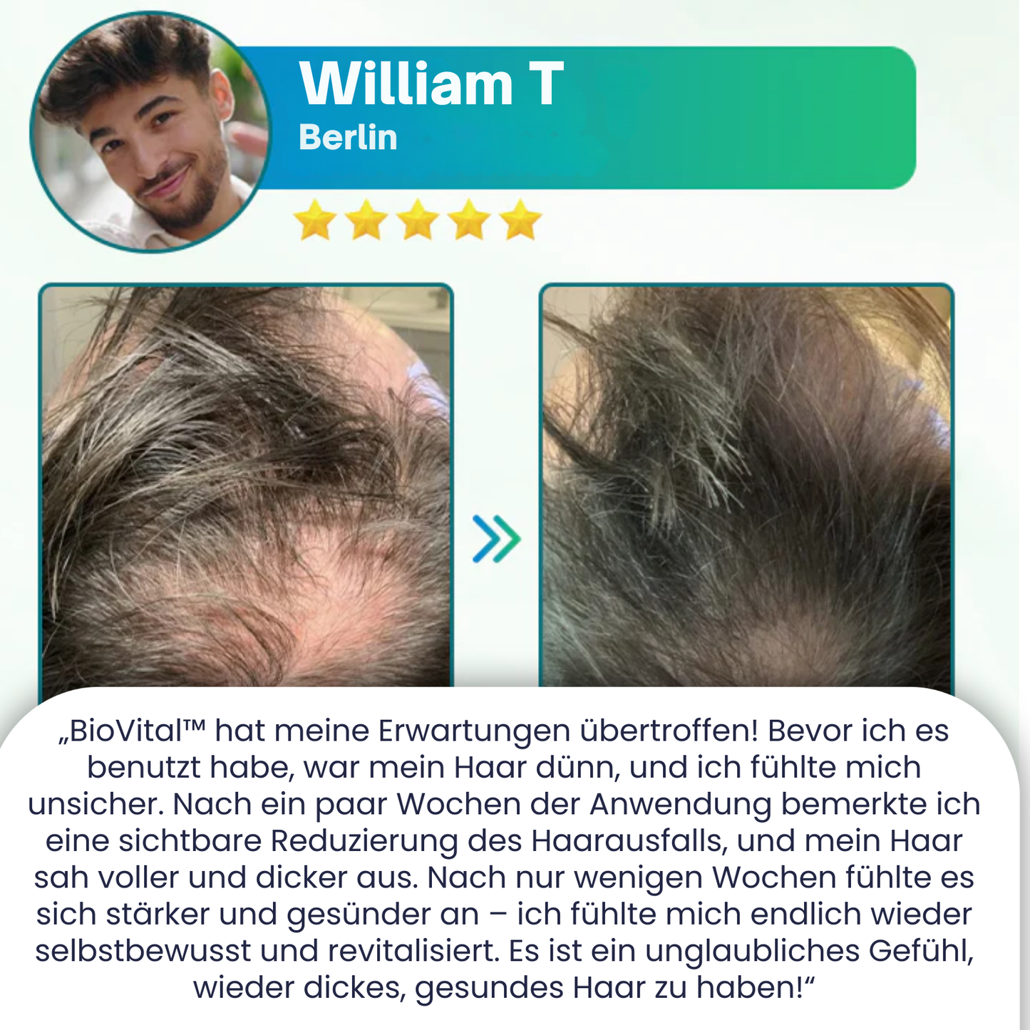 BioVital™ Haarwuchs-Spray | Volles, dickes Haar in 7 Tagen!