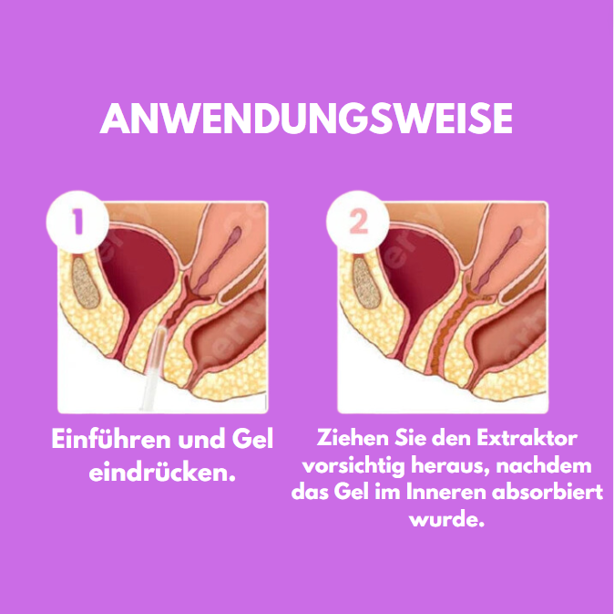 SecureFlow™ | Inkontinenz sofort beenden!