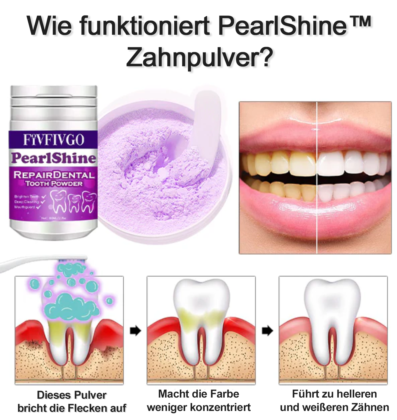 PearlShine™ | Freuen Sie sich wieder auf strahlende Zähne!