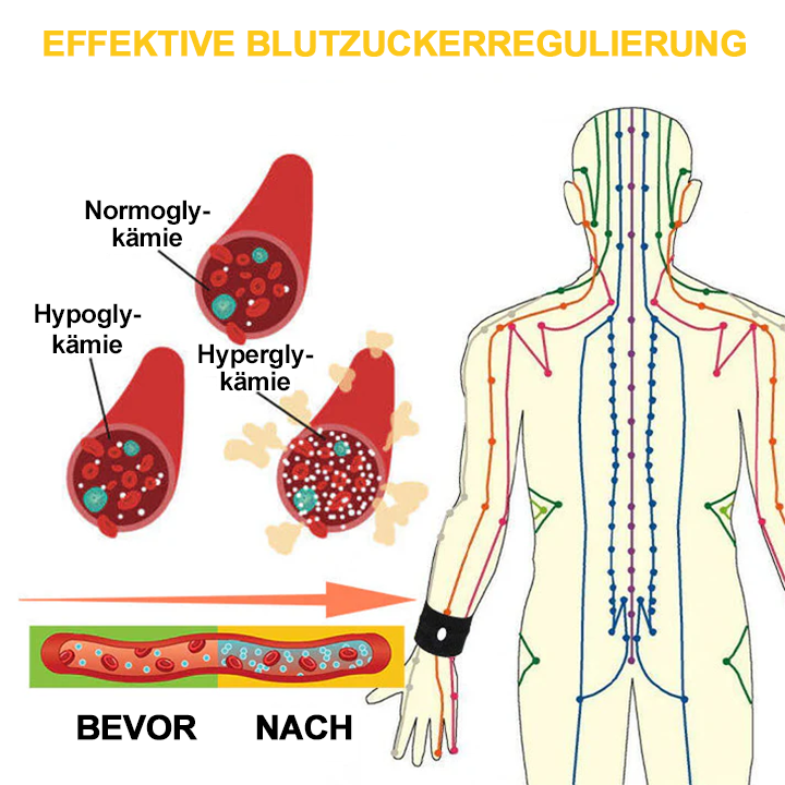 SugarBalance™-Armband | Genießen Sie noch heute ein gesünderes Leben!