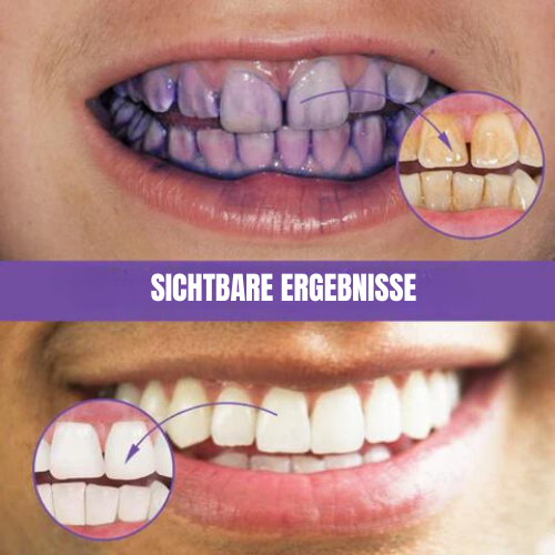 Purple Withening Toothpaste