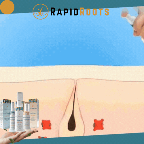 RapidRoots | Formel für Haarwachstum