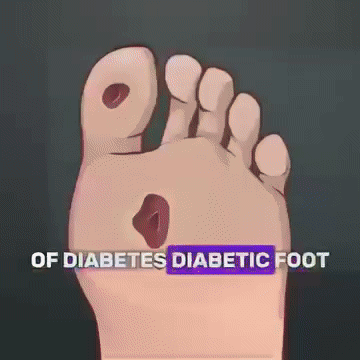 GlucoEase™ | Massageöl für Diabetiker