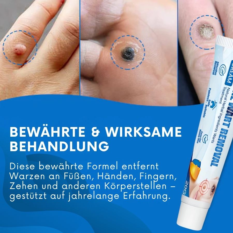 Tagiva™ | TagGone Warzenentfernungscreme