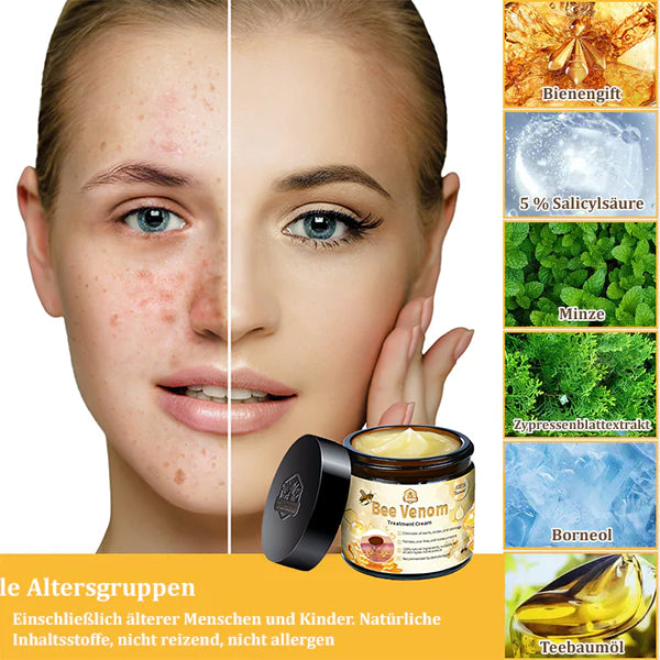 Dermatest-Zertifizierung | ApisGlow™ Bienengift-Hautcreme Bienengift-Hautcreme (BfArM empfohlen) (LETZTER TAG 70% RABATT)
