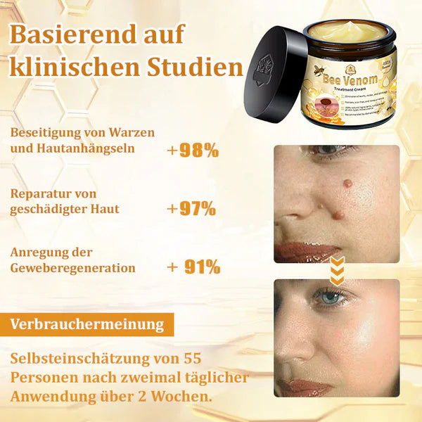 Dermatest-Zertifizierung | ApisGlow™ Bienengift-Hautcreme Bienengift-Hautcreme (BfArM empfohlen) (LETZTER TAG 70% RABATT)