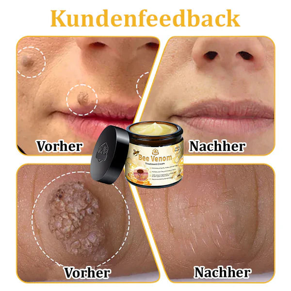 Dermatest-Zertifizierung | ApisGlow™ Bienengift-Hautcreme Bienengift-Hautcreme (BfArM empfohlen) (LETZTER TAG 70% RABATT)
