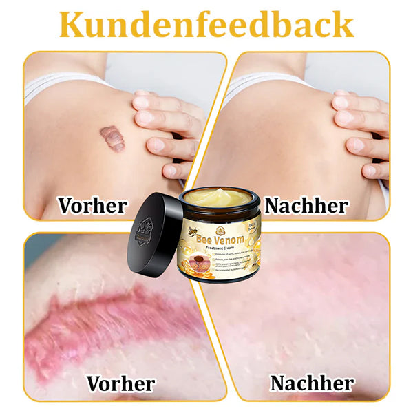 Dermatest-Zertifizierung | ApisGlow™ Bienengift-Hautcreme Bienengift-Hautcreme (BfArM empfohlen) (LETZTER TAG 70% RABATT)
